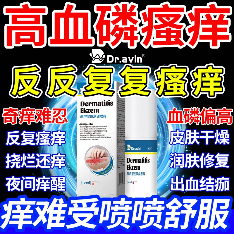 高血磷尿毒肾病皮肤痒血液搭配止痒膏引起皮肤瘙痒药监备案膏SY