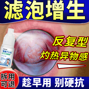 咽喉炎喷雾剂滤泡增生咽喉炎慢性咽炎喉咙有痰可搭专用除根神器E8