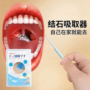 扁桃体结石吸出器家用扁桃体结石吸取器出隐窝神器扁桃体去异味