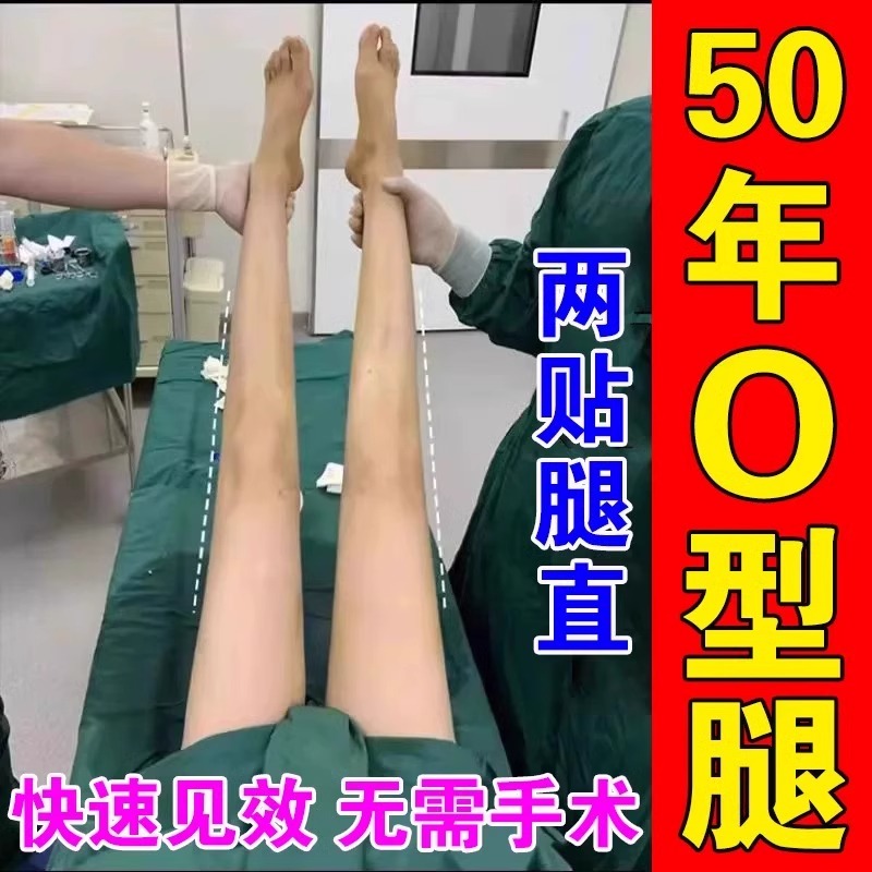 o型腿矫正神器【不手术】EX0型腿小腿膝外八翻罗圈腿纠正腿型贴膏