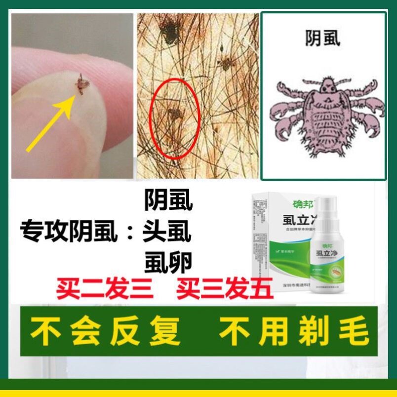 阴虱阴虱净虱立净通济挤堂克虱露阴虱男士用成人喷剂神器的灭虱卵