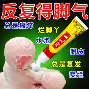 冶脚气止痒脱皮杀菌真菌脚痒水泡专用根去特效烂脚丫糜烂脚趾药王