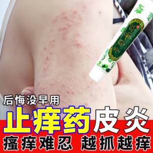 正品越洋千年奇草皮肤瘙痒止痒膏药疹湿顽固皮炎全身痒抑菌乳膏