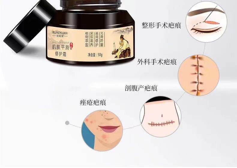 祖传膏去增生性疤痕凸疤刀疤手术疤疤点斑疤纹身疤洗眉疤