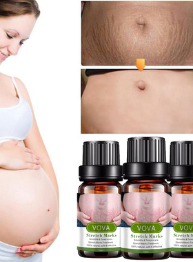 VOVA Remove Stretch Mark Essential oil 10ml