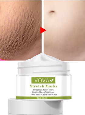 跨境vova产妇肚子纹霜120g预防孕妇产后妊娠纹修复霜