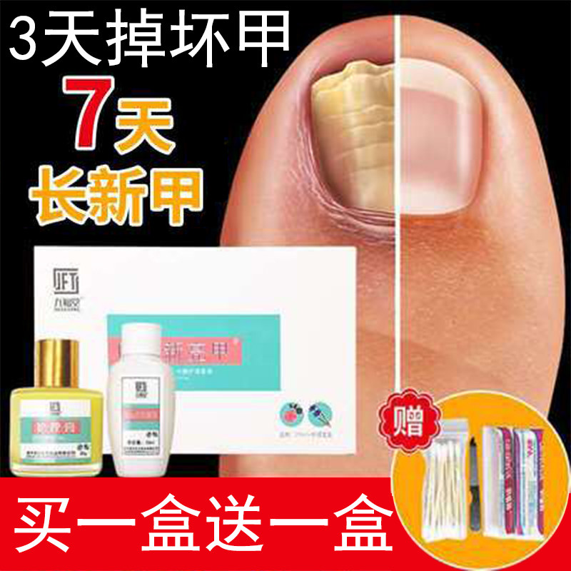 九福堂新亮甲抑菌液亮灰甲灰甲净正品官网新靓甲黑指甲抑菌霜外用