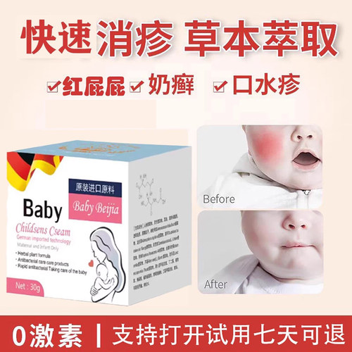 Baby婴儿宝宝湿痒膏奶藓膏热疹红屁屁去口水疹新生儿童皮肤无激素