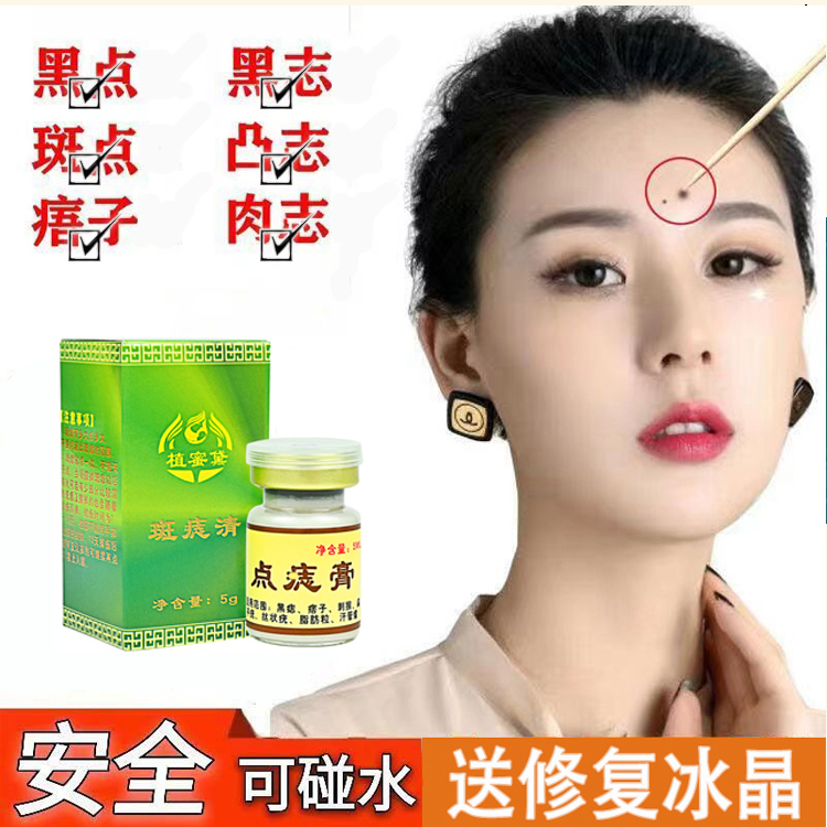 美容院专用黑痣点斑笔祛除脸部黑色素雀斑黄褐斑老年斑祛斑液正品