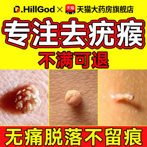 【抗HPV祛疣药膏】一抹无忧