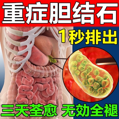 治疗胆结石溶石化石排石特效专用药金钱草中草药胆囊息肉贴