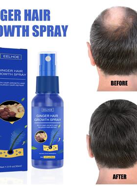 EELHOEGinger Hair Growth Serum Spray Anti Hair Loss Regrowth