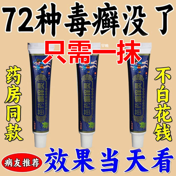 治疗牛皮手足脚体股头皮鲜藓肤瘙痒毒痒克星专外用膏正品杀菌药