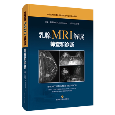 乳腺MRI解读:筛查和诊断