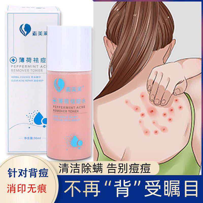 祛痘闭口粉刺的克星长痘痘护肤品