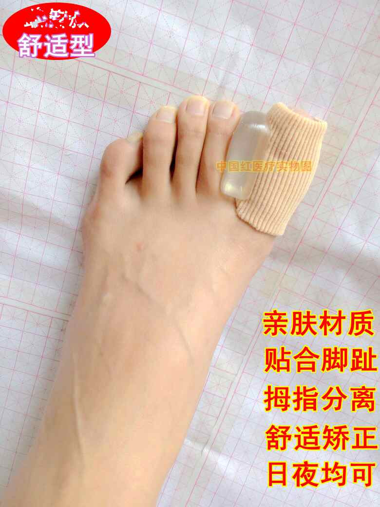 外翻大脚趾头拇指拇外翻矫正器分离分趾矫形大脚骨日夜用可穿鞋