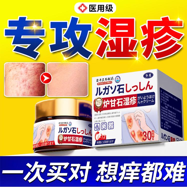 湿疹膏止痒去外用顽固皮炎根宝宝水泡专用除湿阴囊瘙痒皮肤膏DL
