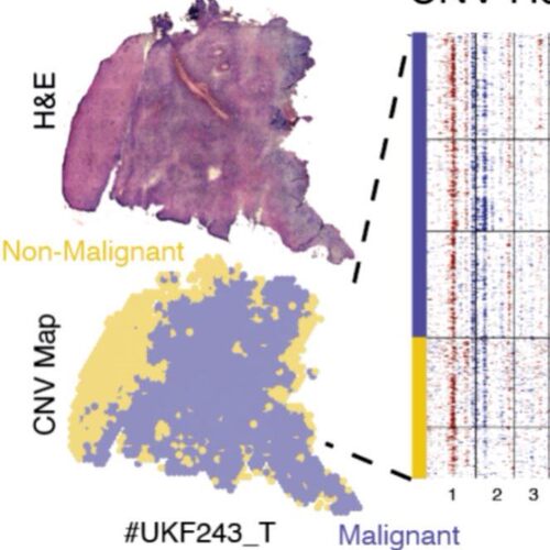 空间转录组分析空转分析spatial10xgenomics空转联合单细胞ST分析