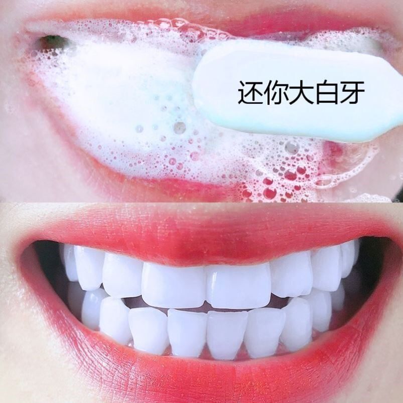 屈臣氏爆火~牙渍一刷即除~黑色烟渍~茶渍~去牙菌斑咖啡渍牙齿变白