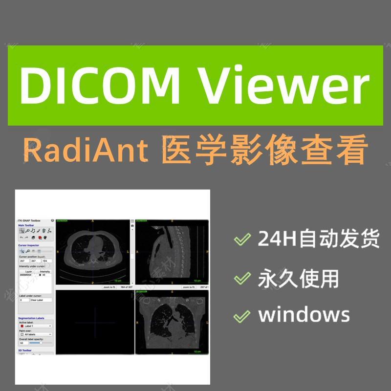 radiant dicom viewer软件远程安装 2021.2.2免注册医学影像浏览