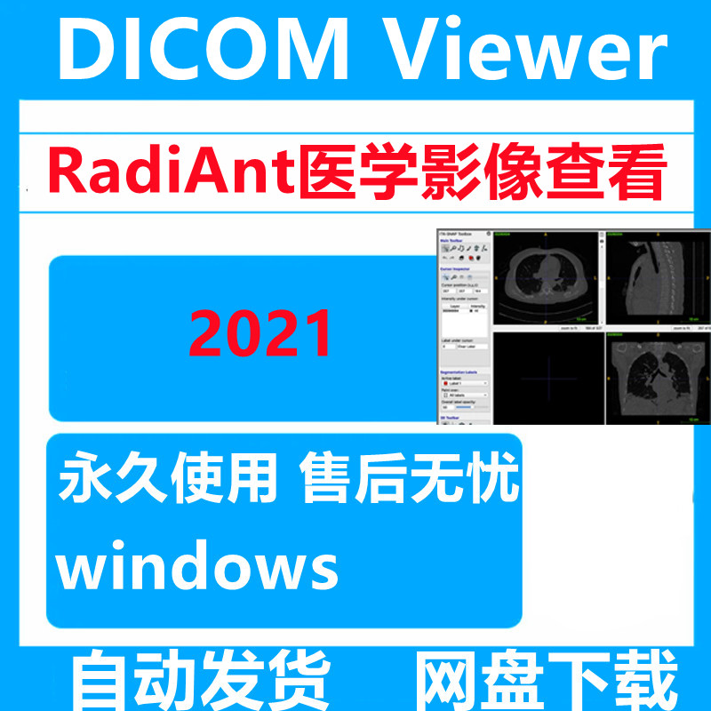 radiant dicom viewer软件远程安装 2021.2.2免注册医学影像重建