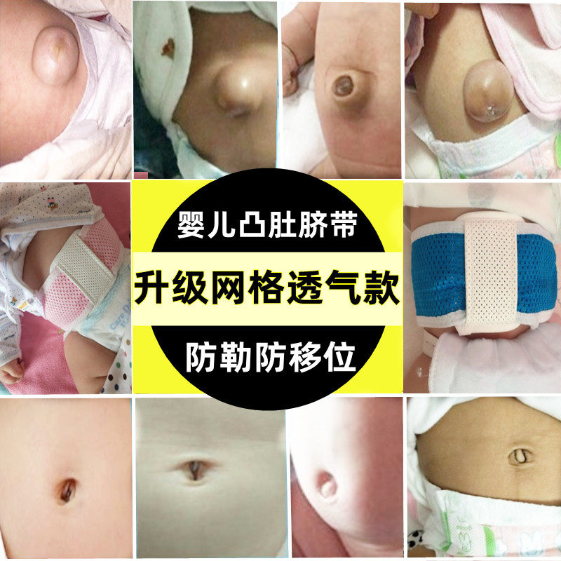 护脐带压肚脐脐疝带袋凸鼓肚脐贴