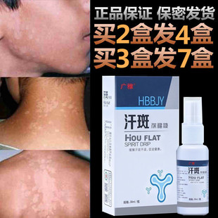 汗斑专用喷剂香露花斑藓马拉色菌感染玫瑰糠疹止痒非药皂白汉斑治