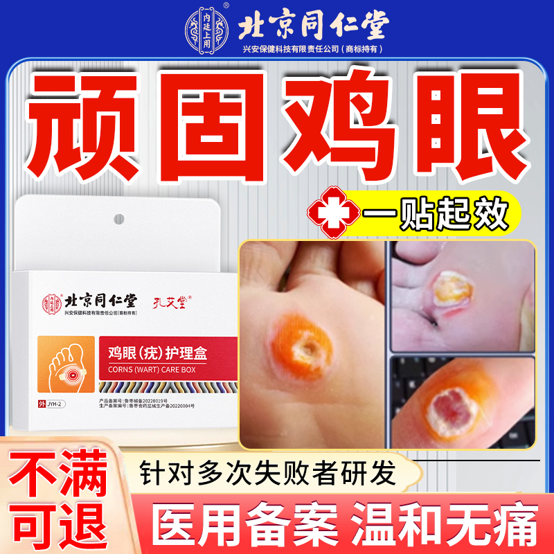 鸡眼贴官方旗舰店除膏非日本水杨酸脚肉刺跖疣瘊子根药膏去肉刺