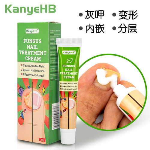 Nail Fungus Cream 20g指甲膏 ebay Lazada Joom跨境热销Shopee