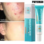 Acid Spots Acne Cream Salicylic Pimple Treatment Repair Deep