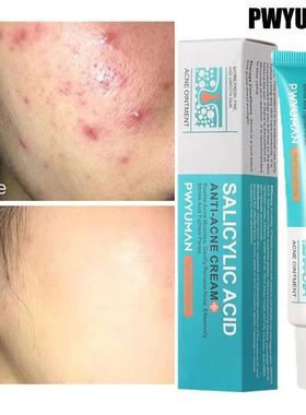 Salicylic Acid Acne Treatment Cream Repair Pimple Spots Deep