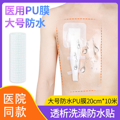 医用腹透洗澡防水贴腹膜透析敷贴
