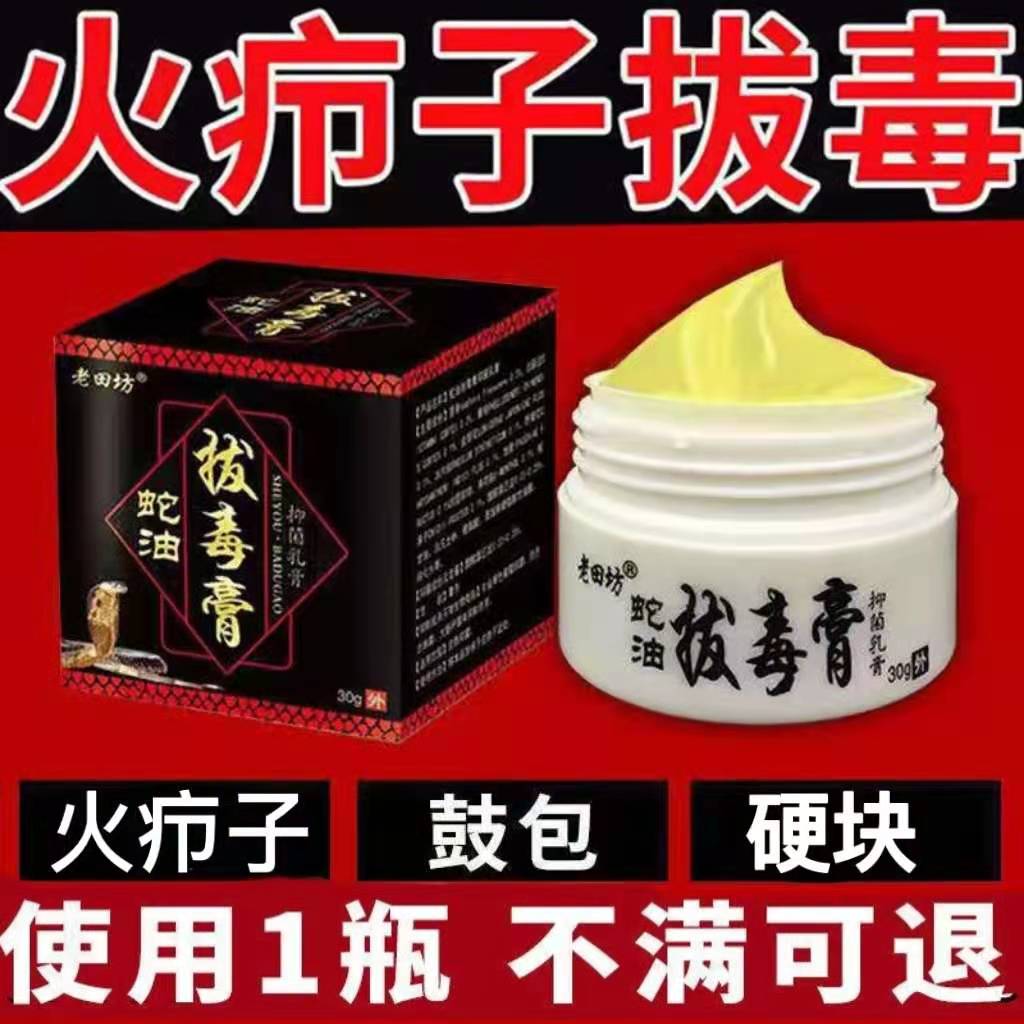 正品治火疖子拔毒膏药贴吸脓