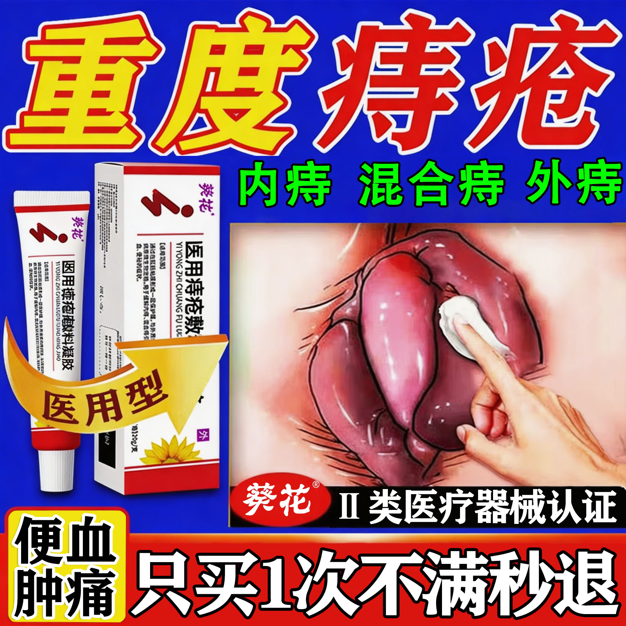 葵花医用痔疮膏排行榜第去一特内外混合大便出血效专用消肉球凝胶