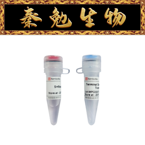 赛维尔末端脱氧核糖核酸转移酶