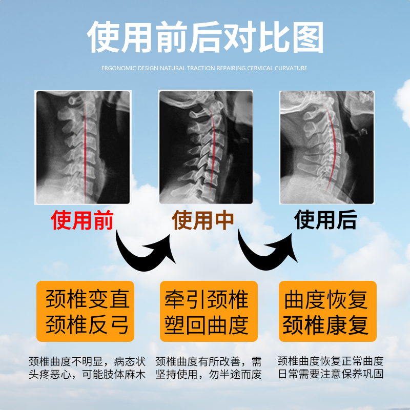 颈椎变直矫正枕头硬枕不塌陷颈椎专用小圆枕糖果枕专治颈椎圆柱枕