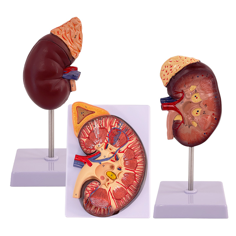 肾脏模型人体内脏模型骨骼自然大肾解剖附肾上腺模型标本