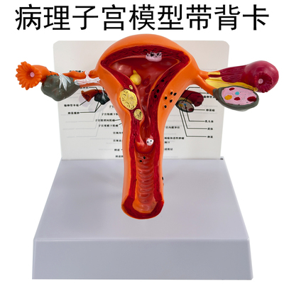 妇产生殖卵巢高级病态子宫模型