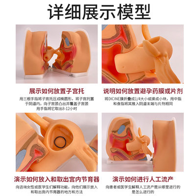 女性生殖器模型宫颈p子宫外阴道卵巢妇科检查避孕教学训练1比1