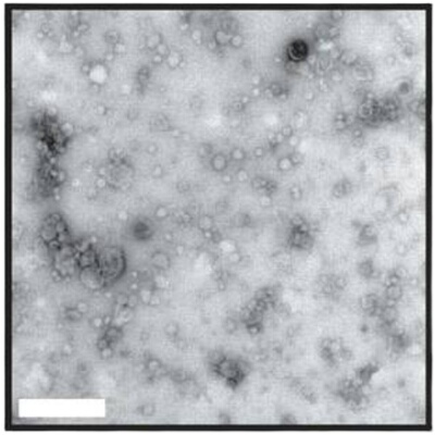 外泌体常规鉴定-提取 粒径检测（NTA) 透射电镜（TEM）WB 高性价