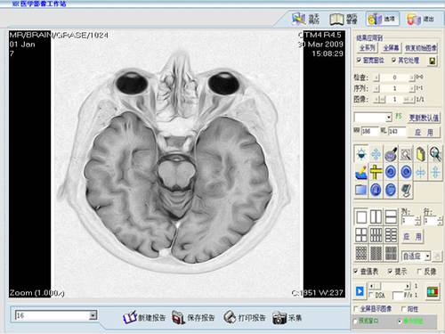 MR磁共振工作站MR工作站CT磁共振胶片打印系统DICOM工作站