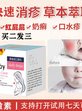 婴儿宝宝湿热疹膏奶藓膏痱红屁屁去口水疹新生儿童皮止护痒肤霜炎
