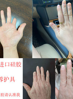丹蓉通用上海手指假肢硅胶义肢