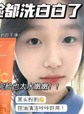 维生素C氨基酸洁面乳提亮去黑头深层清洁学生党洗面奶控油淡痘