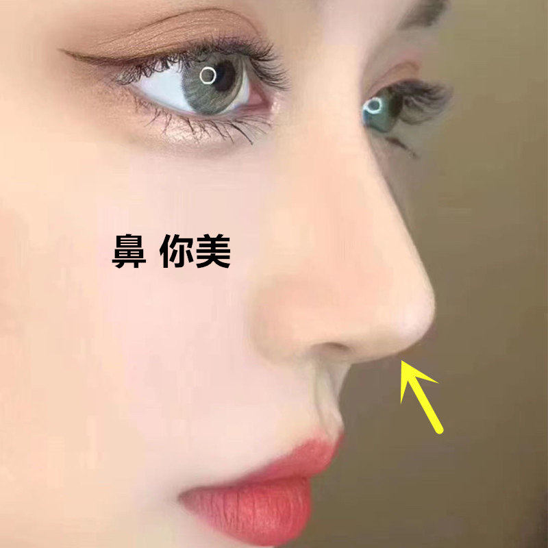 【挺出你的新高度】美鼻精油 抹出自然挺 告别丑鼻子 158元三瓶