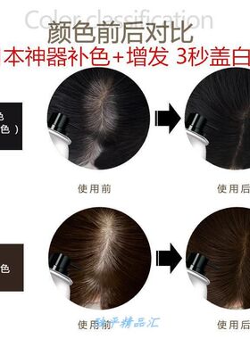 h一次性增发密发纤维喷雾头发钎维粉日本变密变多假发补浓美发