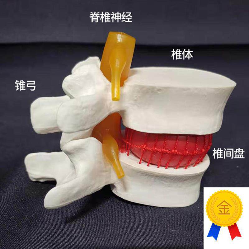 椎间盘模型正品医学人体腰椎突出脊柱脊椎骨O病理演示关节标准模