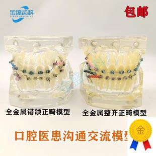 牙科模型正畸结扎丝托槽口腔教B学模型牙齿错颌矫正展示透明牙模