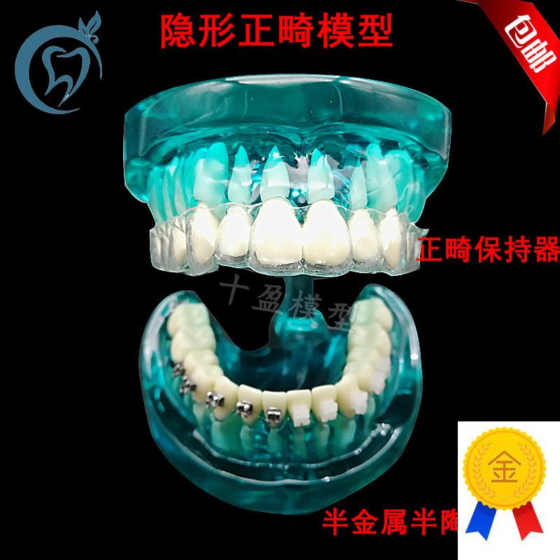 牙科隐形a正畸模型正畸保持器示范正畸半金属半陶瓷托槽对比包邮