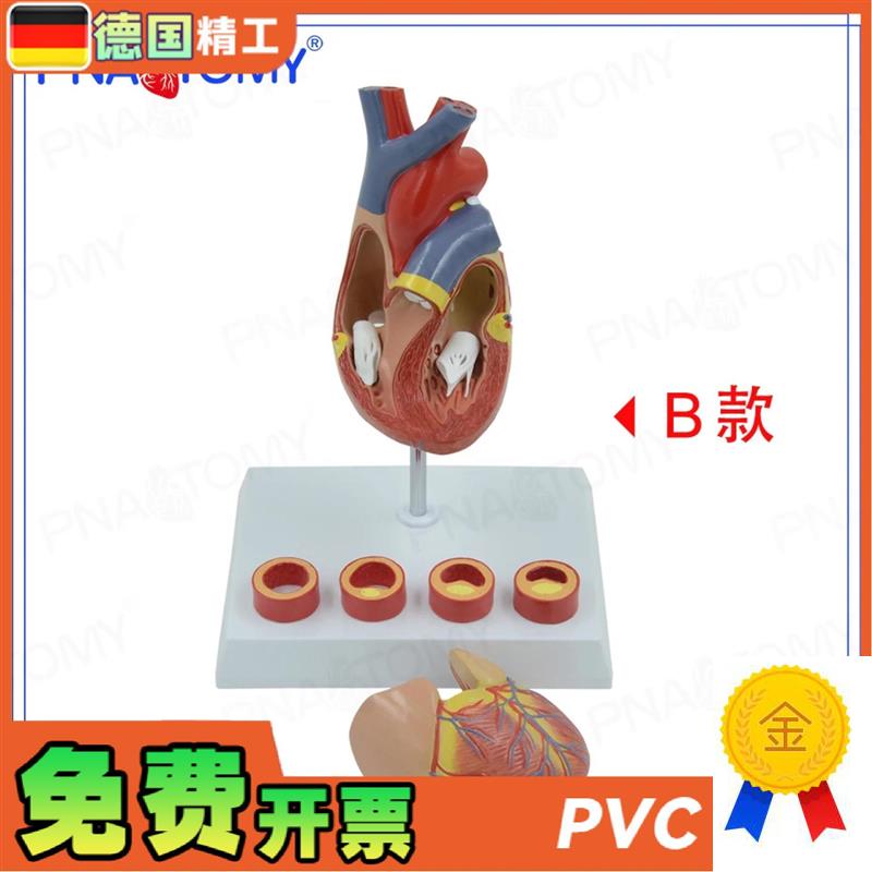 德国】PbNT-0724心脏模型4阶段血管动脉病理期心脏解剖心血管科展